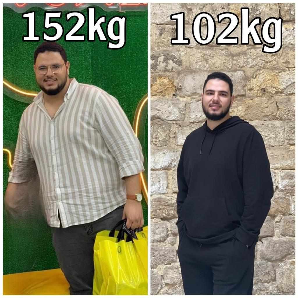 Before and after transformation for Abdelrahman Zahran