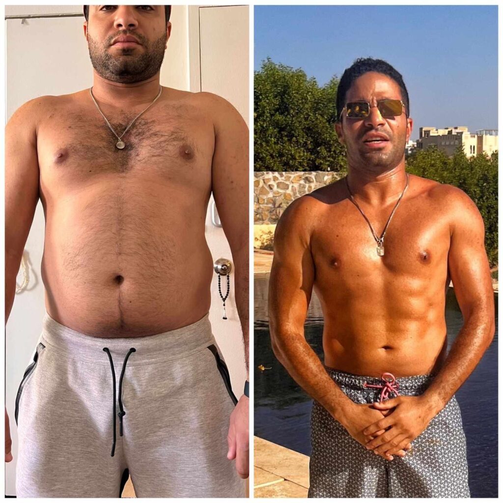 Before and after transformation for Ahmed Damby