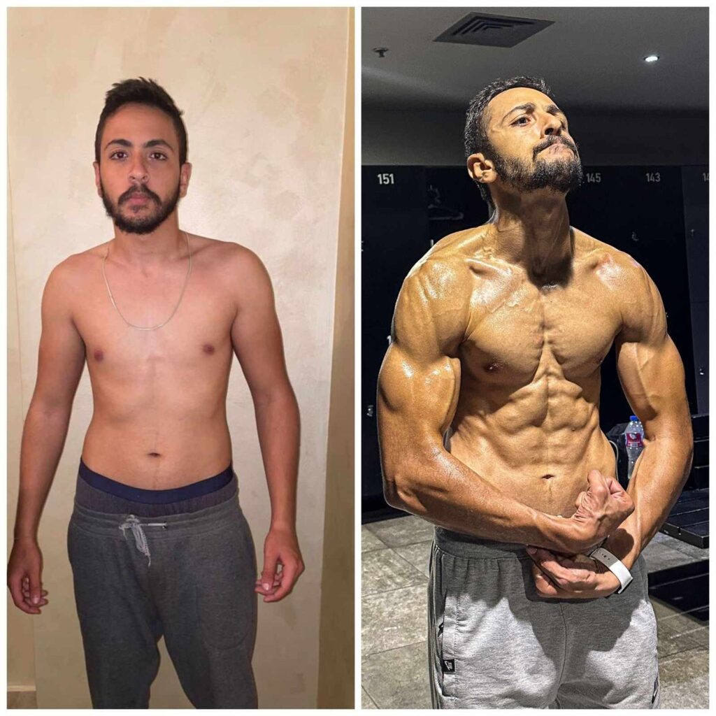 Before and after transformation for Yousef Sobhy